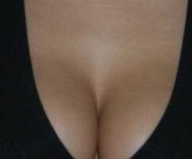 Esibizionismo - Callosa - punga.club